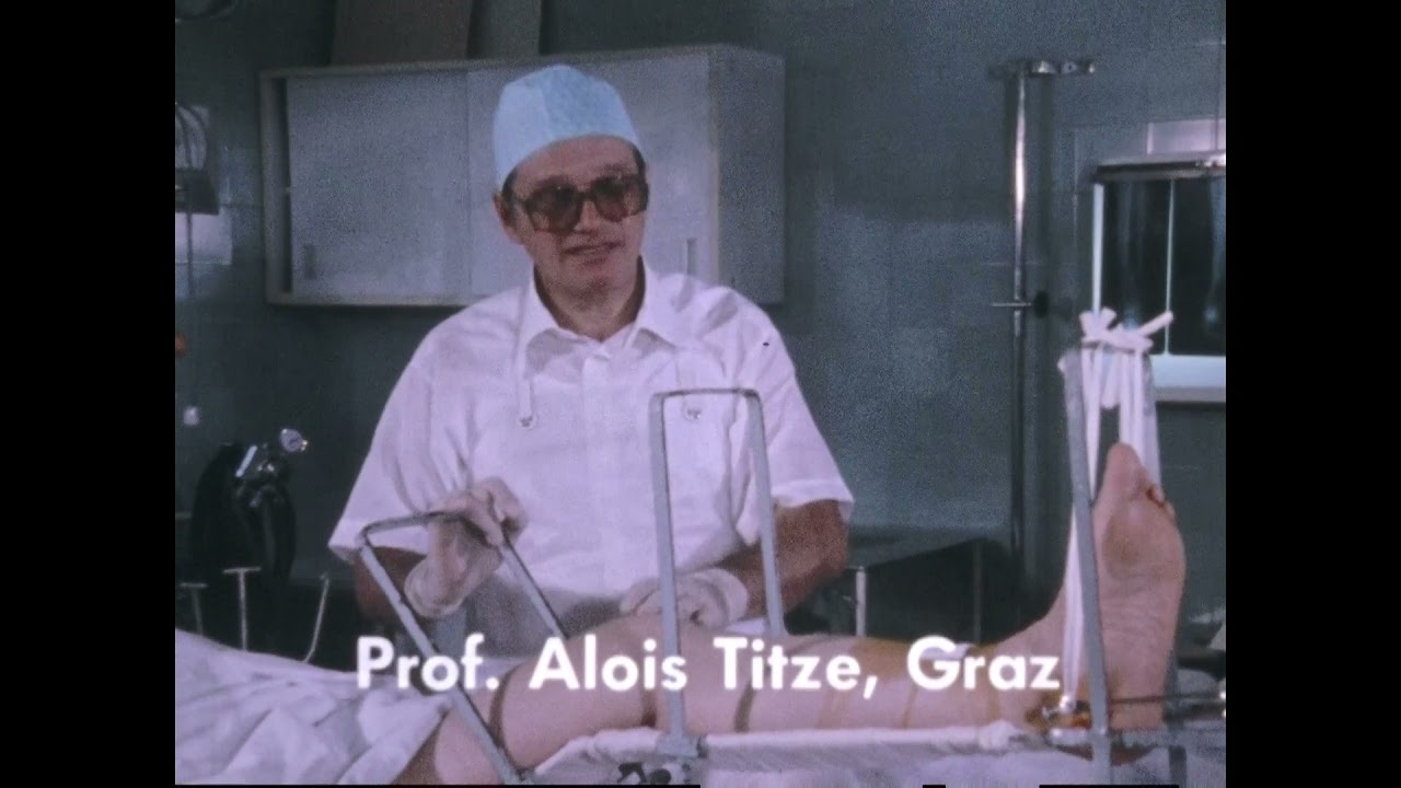 Behandlung nach B&ouml;hlers Methode im Dokumentarfilm &laquo;Auf Biegen und Brechen&raquo;, 1981