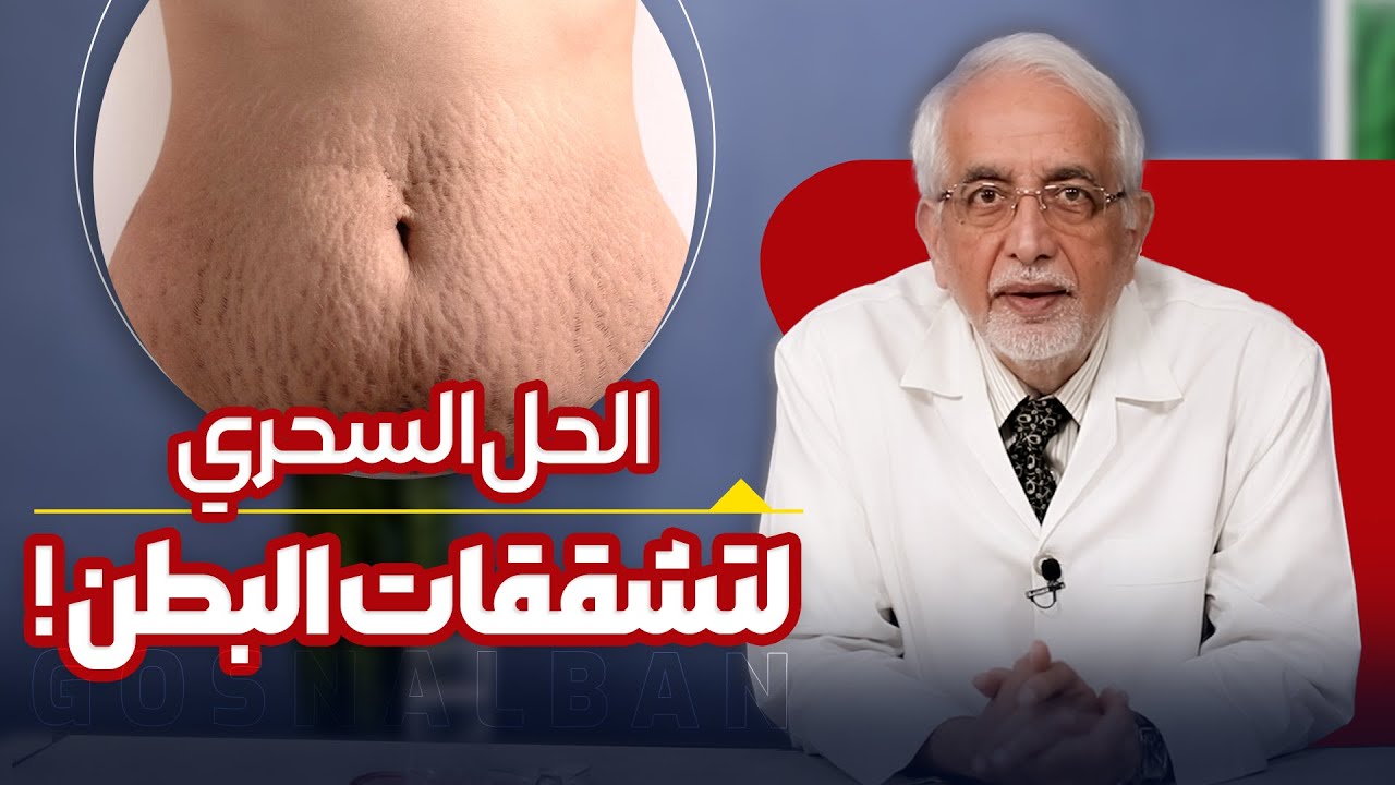 علامات تمدد الجلد 
