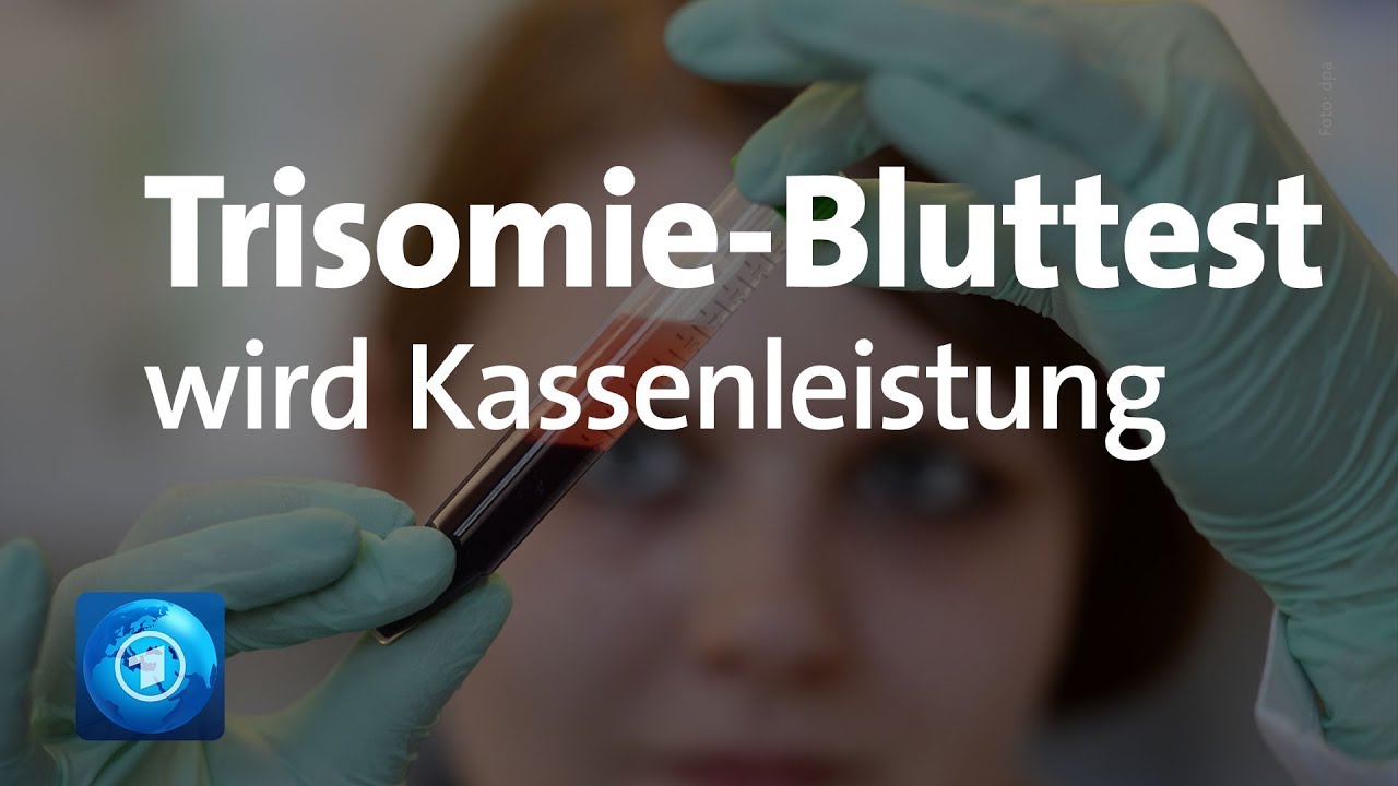 Kasse zahlt Bluttest auf Down-Syndrom