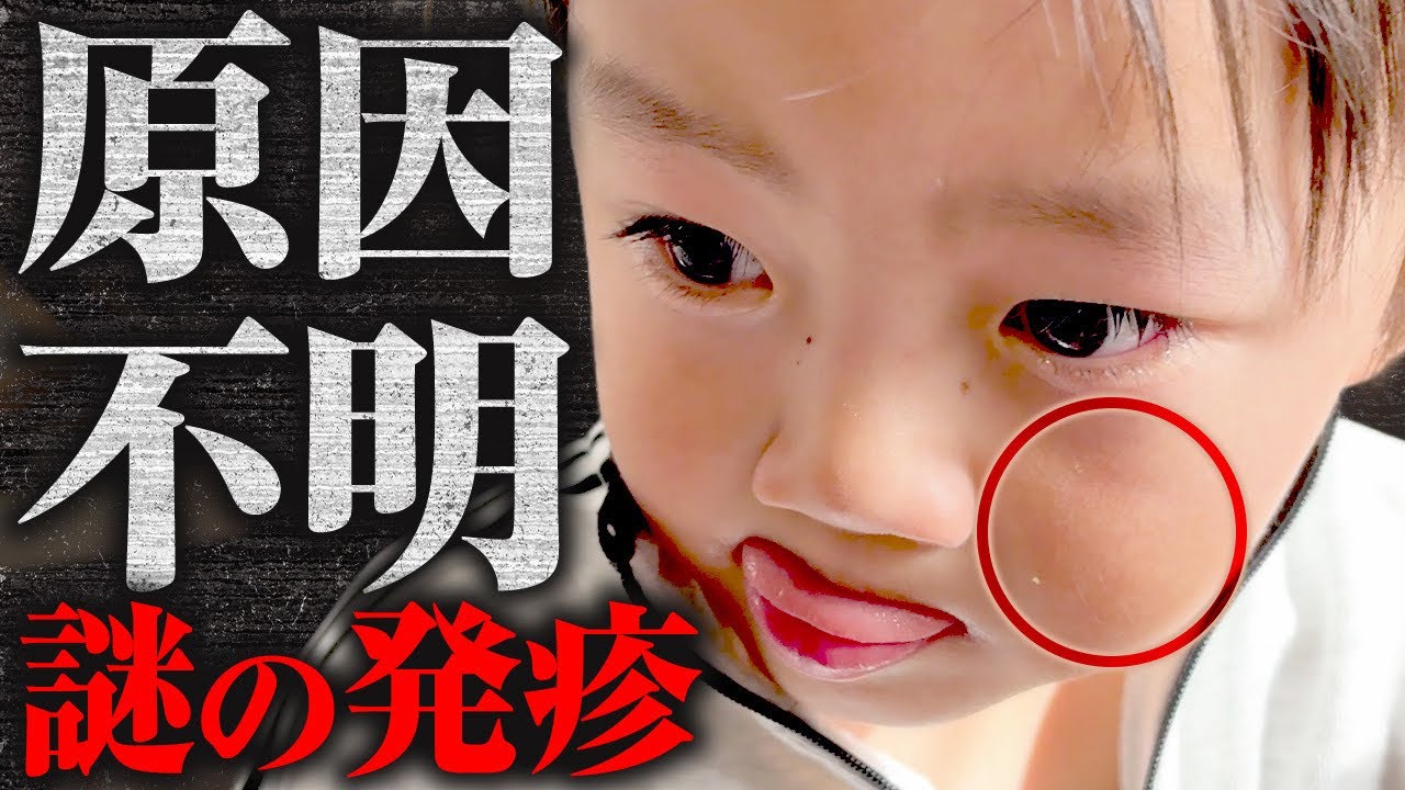 【大阪帰省】ギャン泣きすると顔に発疹が。。。原因が分からない。。。京都旅行中にどこでもドア発見！7才児(小学校1年生)男女双子＆4才児(年少)末っ子の家族旅行
