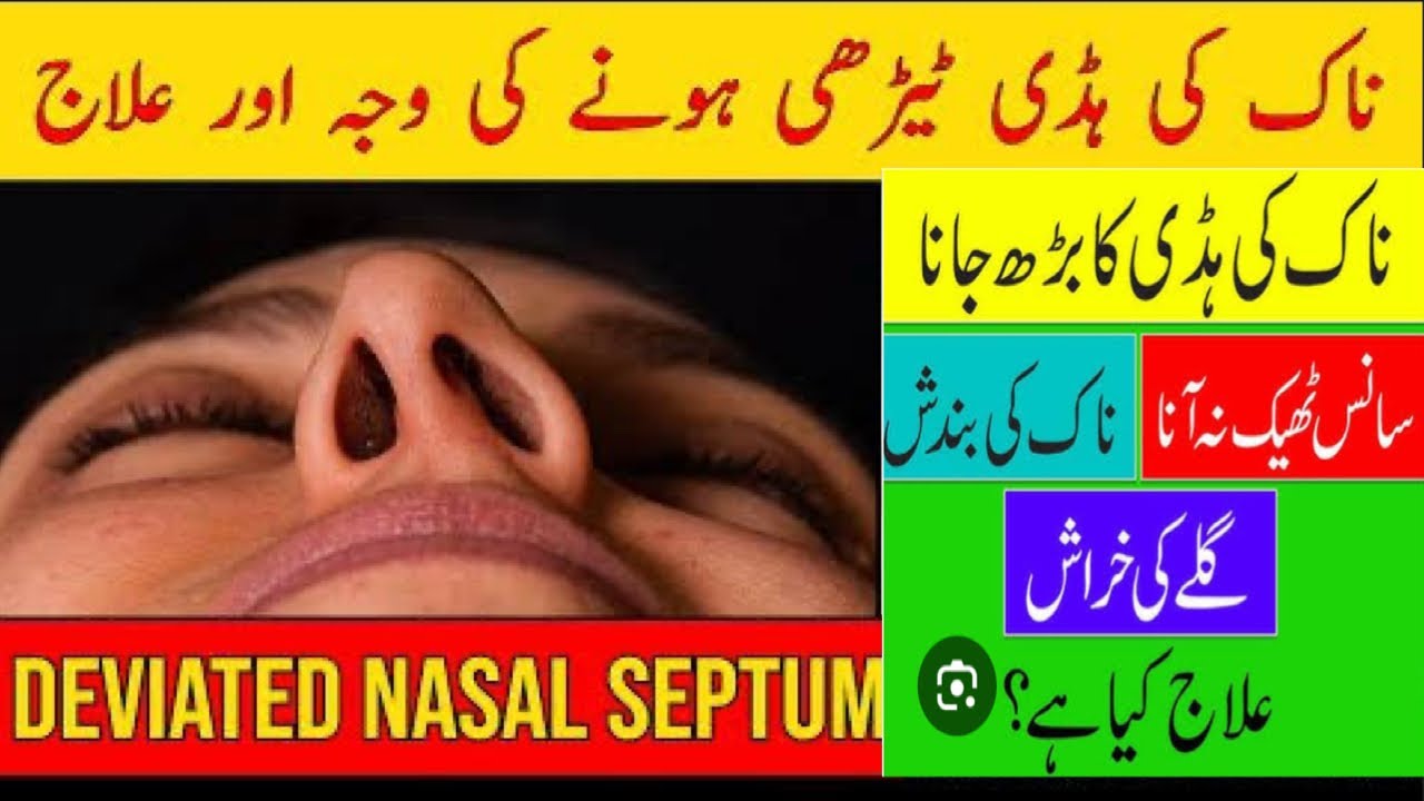 Deviated Nasal Septum Nasal Bone Deviation | Breathing Problems Dr Health Officials 