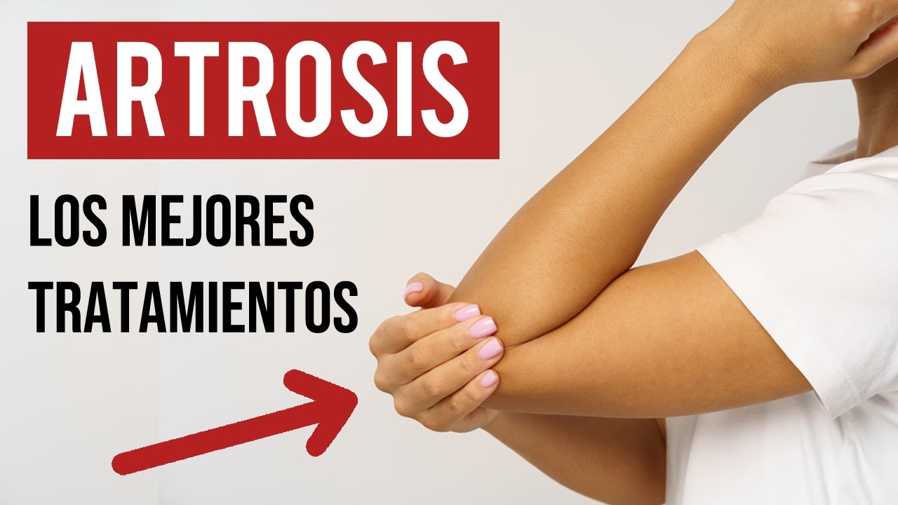 🟢 ¿Qué es la ARTROSIS? , Ejercicios, síntomas y tratamientos.