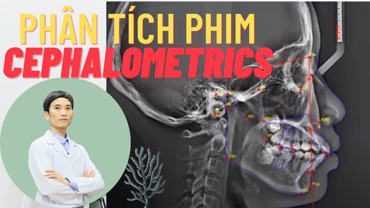 Bài 3: Phân Tích Phim Cephalometrics | Kiến Thức Chỉnh Nha.