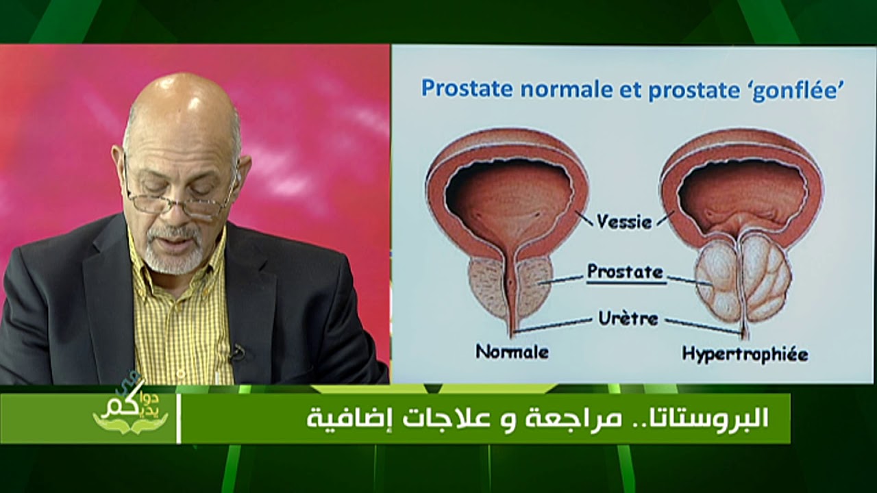 البروستاتا.. مراجعة وعلاجات إضافية