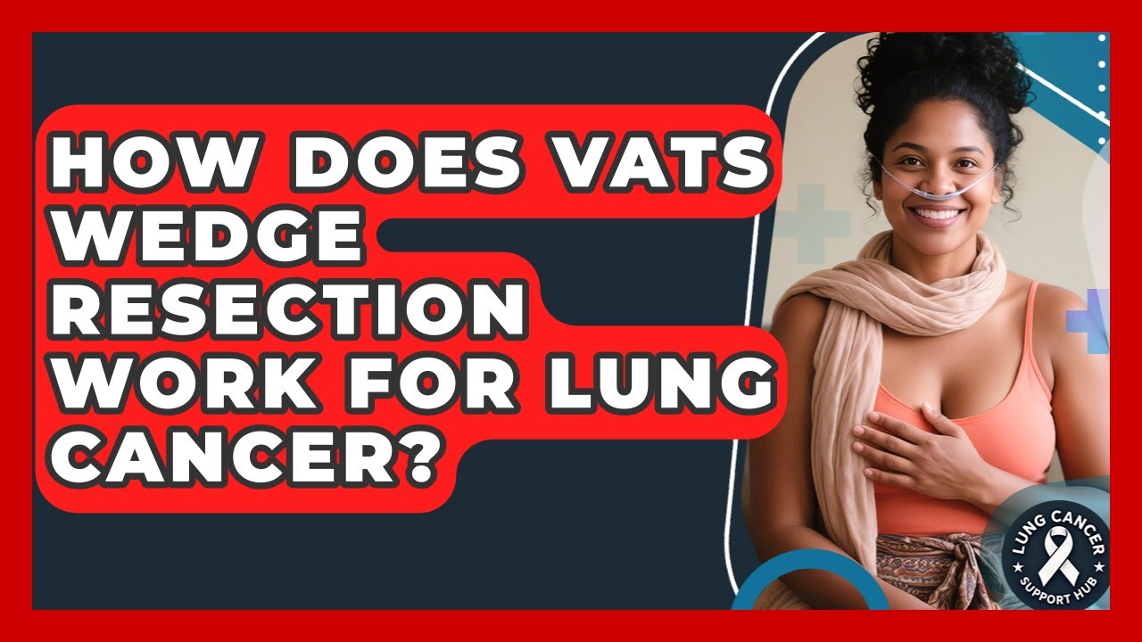 How Does VATS Wedge Resection Work For Lung Cancer? - Lung Cancer Support Hub