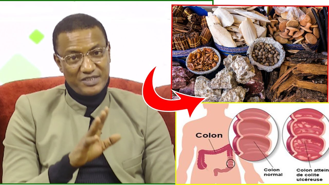 🔴 Finis vos problèmes d'hépatite, colopathie, hémorroïde ...: Dr Abdoulaye Diallo livre le remède