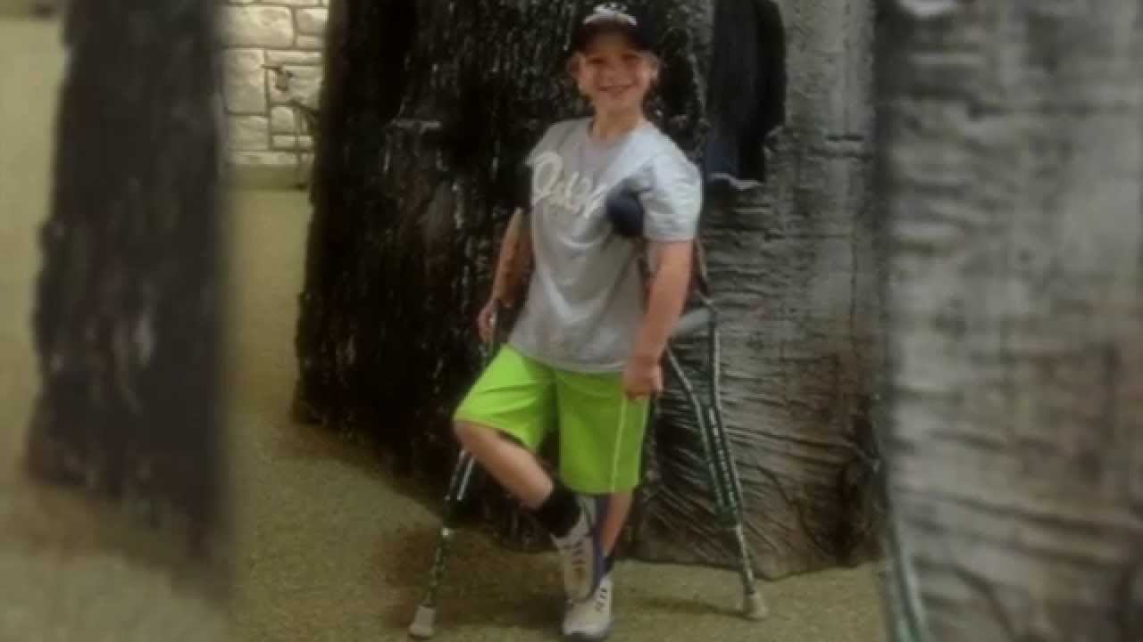 Kolby's Perthes Story