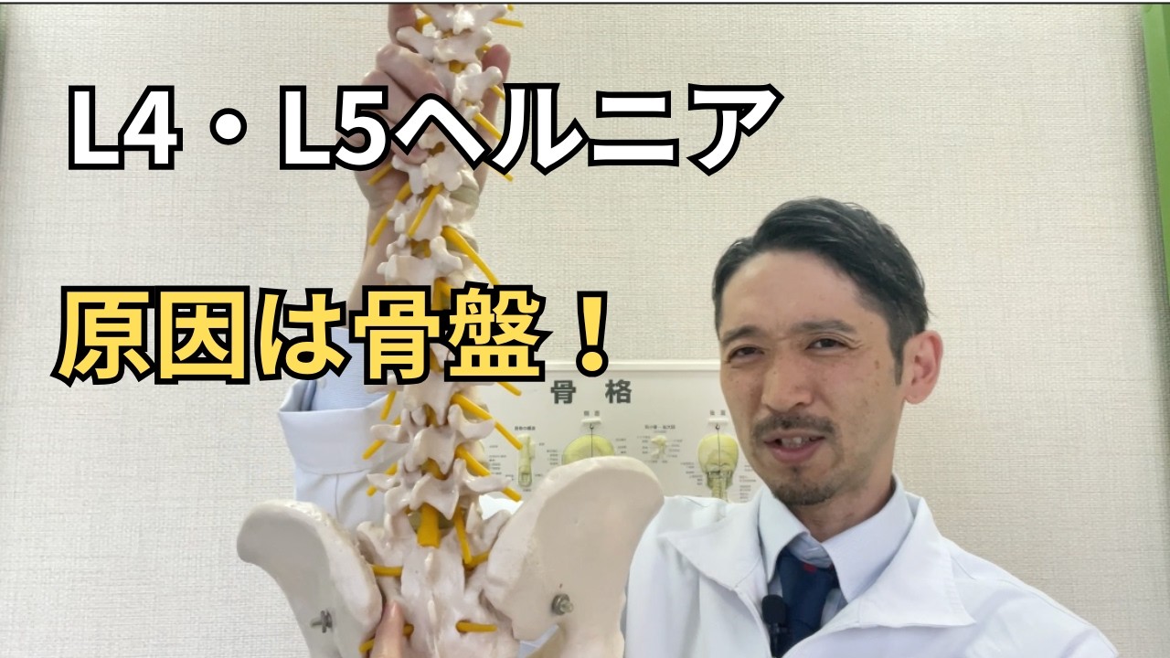 L4・L5ヘルニアの本当の原因｜骨盤が関係していた40代男性の症例