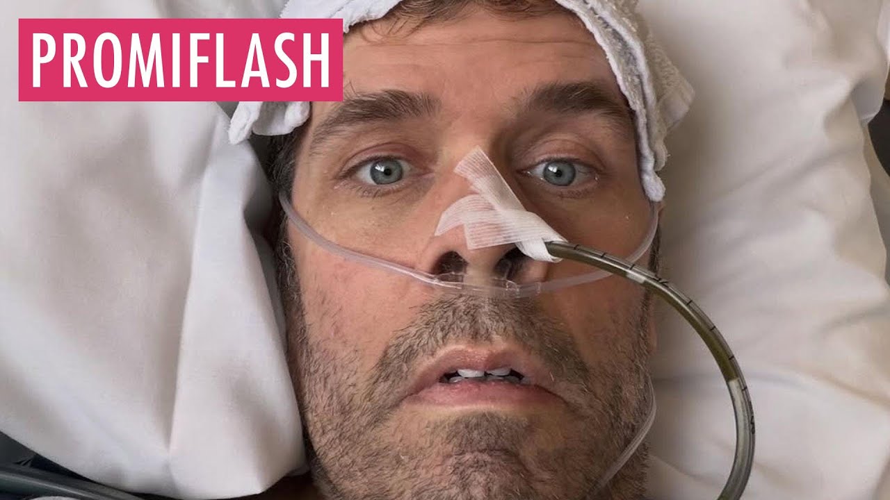 Perez Hilton &uuml;berlebt Sepsis: Seine schockierende Geschichte