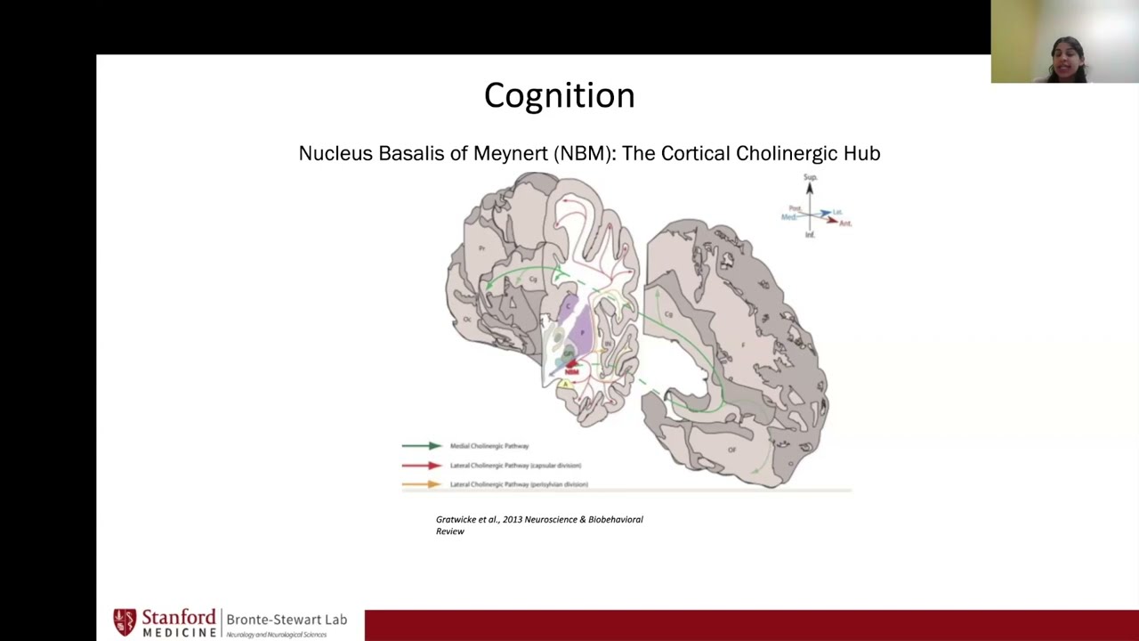 SPRING & NBM Studies for Parkinson’s with or Planning DBS