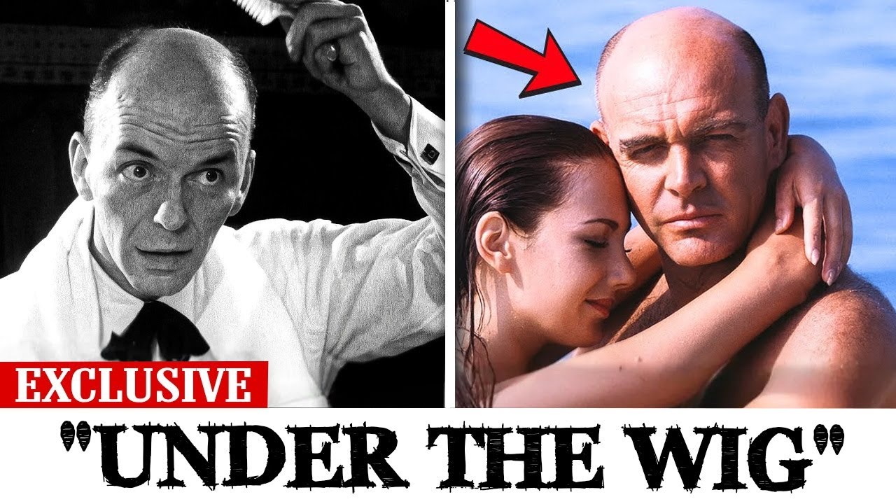 14 Golden Age Stars Who SECRETLY Hid Baldness with Wigs