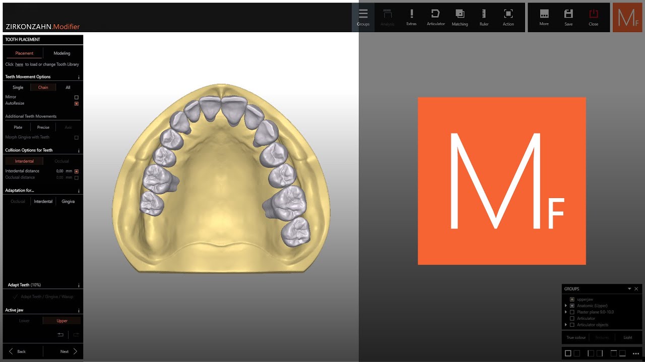 Tooth Setups – Mirror & AutoResize Functions | Zirkonzahn.Modifier