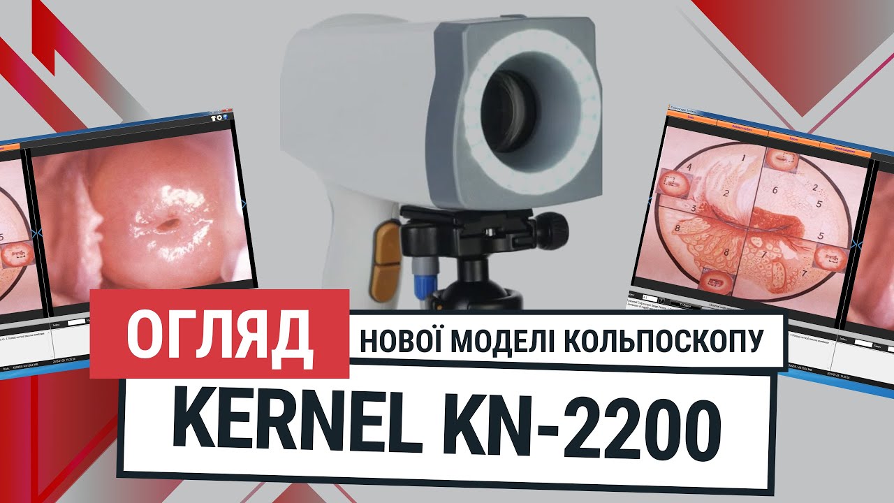 Кольпоскоп KERNEL KN 2200
