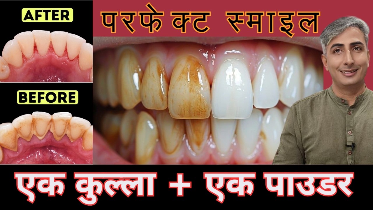 7 दिन में चमकदार सफेद दांत I DR. MANOJ DAS I #drmanojdas #drmanojdasjaipur