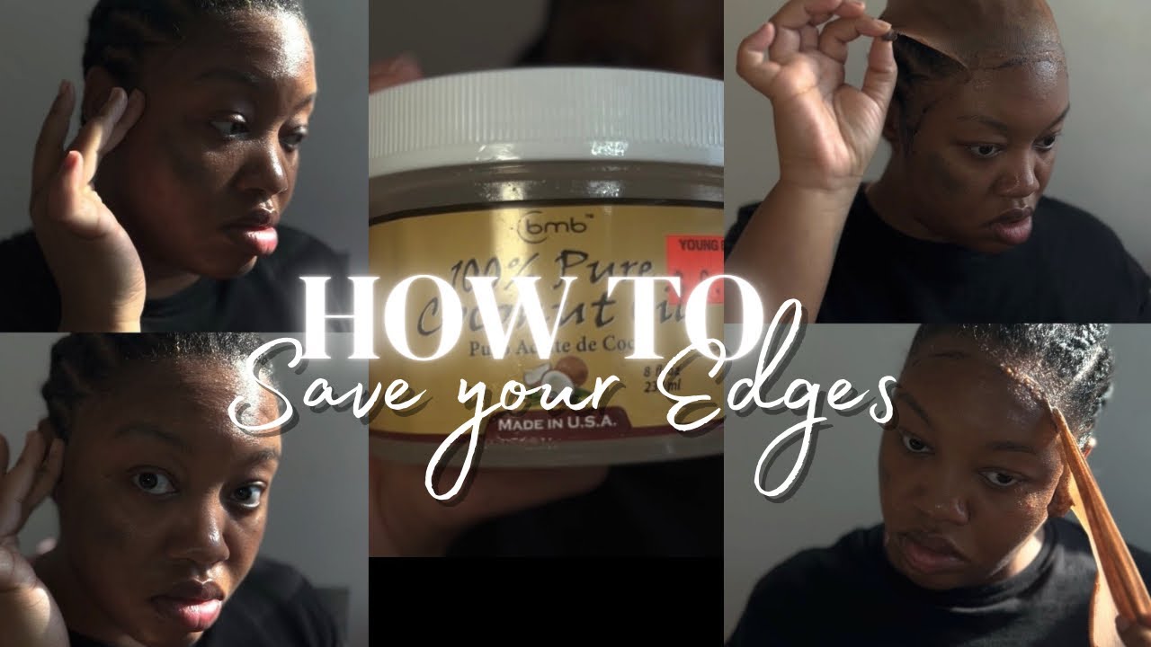 Are Your Edges Thinning From Wearing Wigs ⁉️| New Method To Remove Your Wigs & Save Your Edges