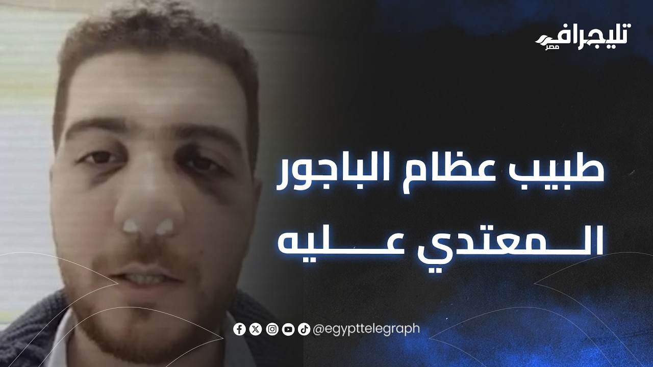 طبيب عظام الباجور المعتدي عليه: متحفظ عليا والمتهم الأساسي في بيتهم