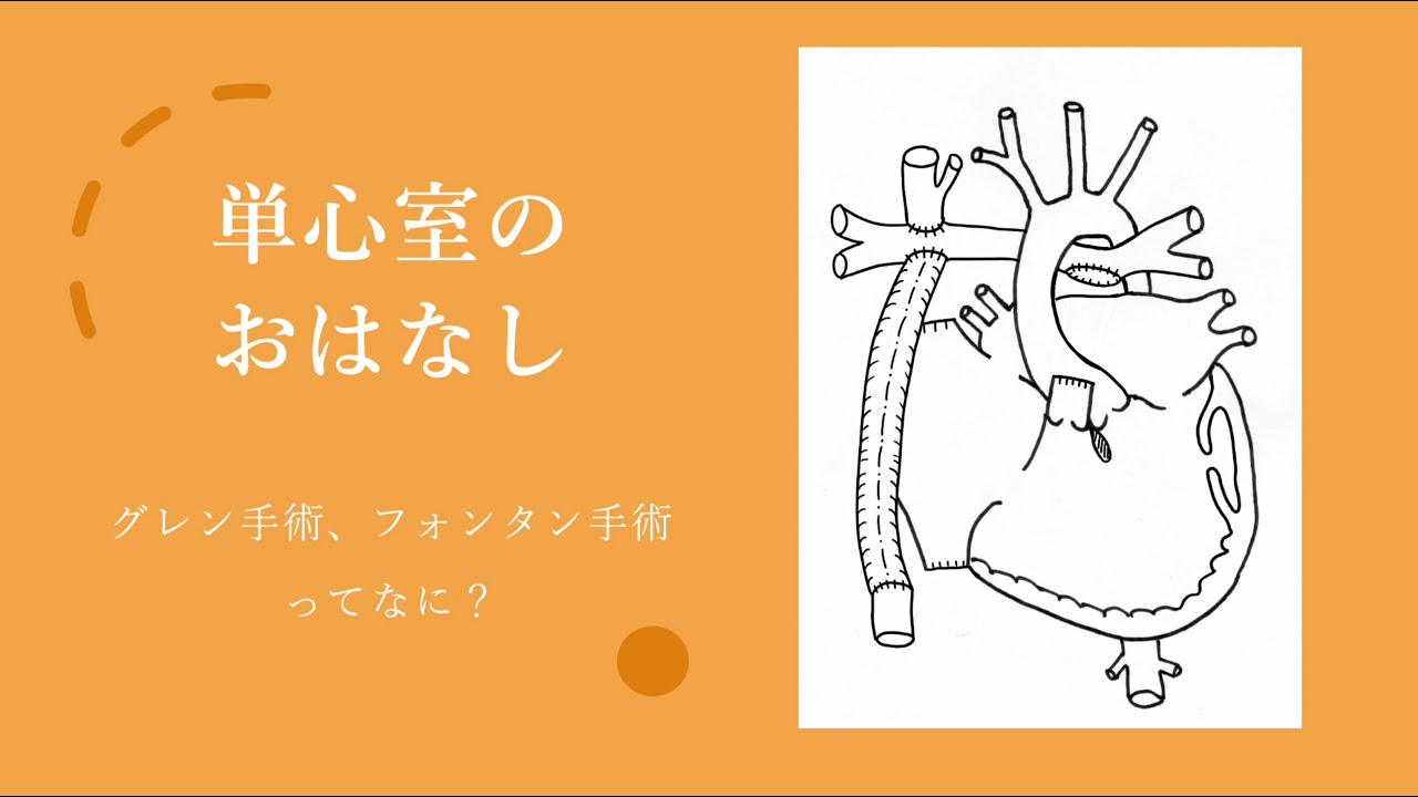 単心室のおはなし