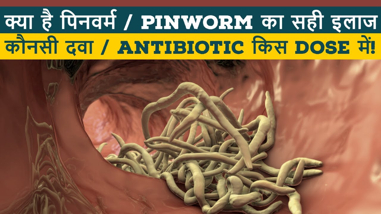 Chunna katne ka ilaj II Pinworm treatment lI Pinworm ki dawa II Chunne ka ilaj II ThyDoc