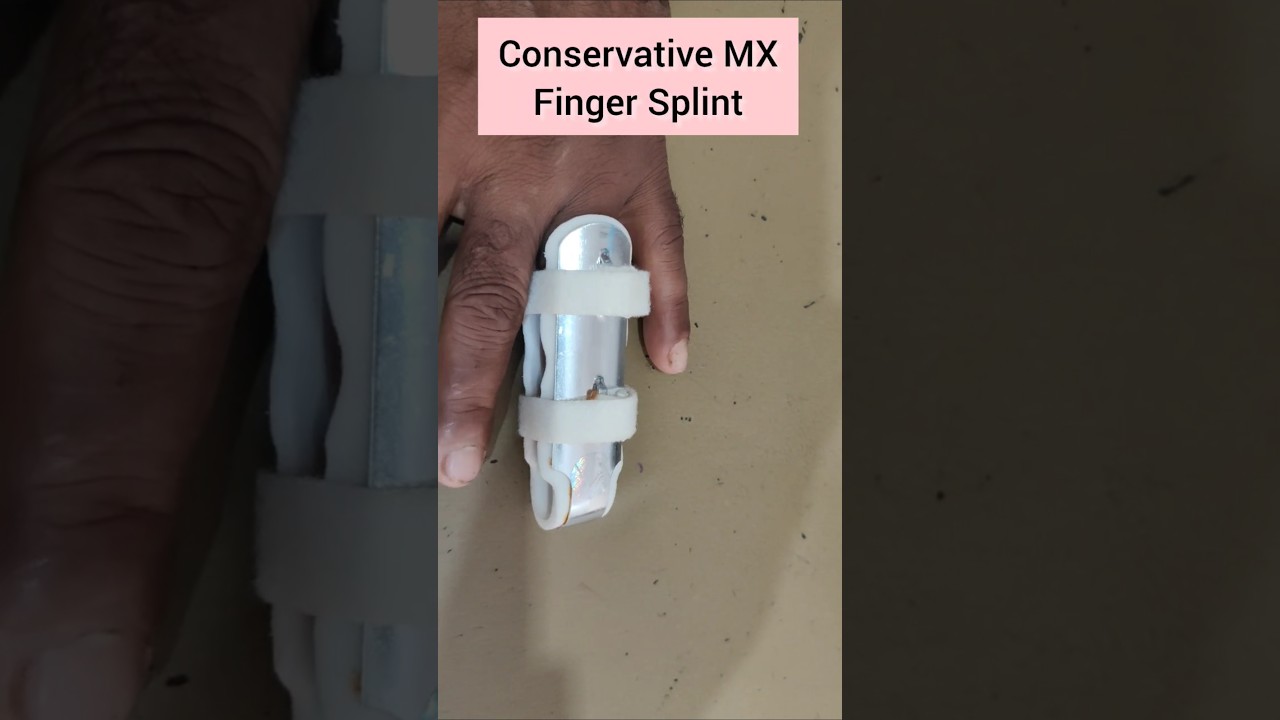 Finger Splint #Conservative Management -Xray - Middle Phalanx of Ring Finger fracture hand#Bone pain