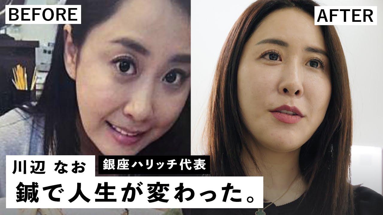 どん底から全国に10店舗以上を構える美容鍼灸院の社長へ｜銀座ハリッチ代表 川辺なお