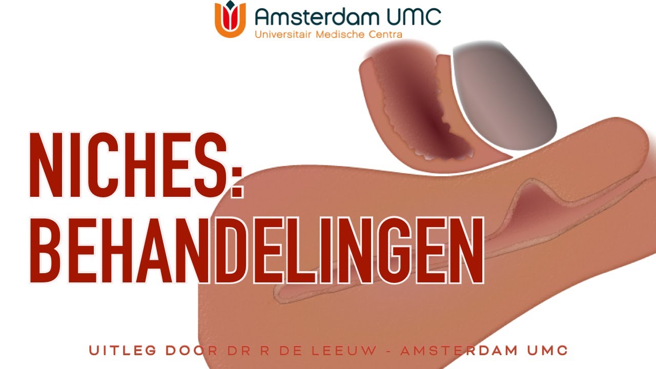 [DUTCH] De niche in de baarmoeder - hoe kan je het behandelen?