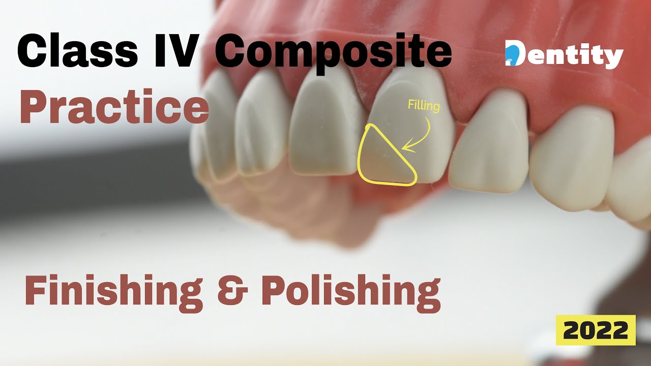 Class IV Finishing & Polishing | تلميع وتنعيم حشوات الأسنان الأمامية