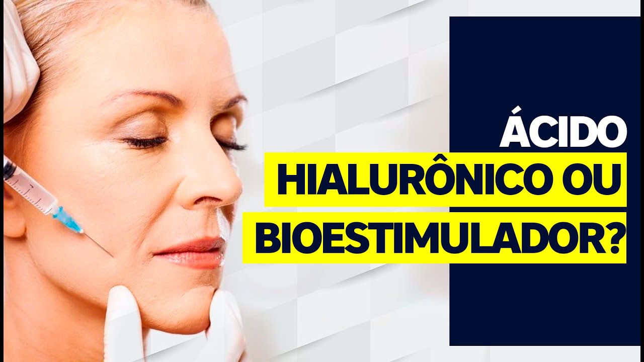 ÁCIDO HIALURÔNICO ou BIOESTIMULADOR: qual escolher? | Dr Vitor Erlacher