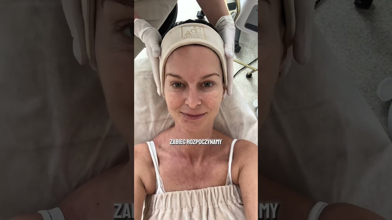 ❗️Microneedle mesotherapy - is it worth it? YES! #cocorecommends #skincare #cococollection #shorts