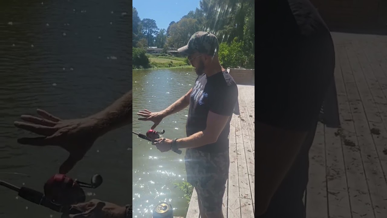 Man Shocks The World With #1 Fix For Sunburn #shorts