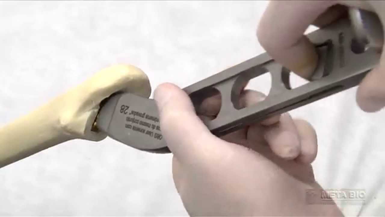 Técnica Cirúrgica para Artroplastia Total de Quadril Não-cimentado Meta Bio