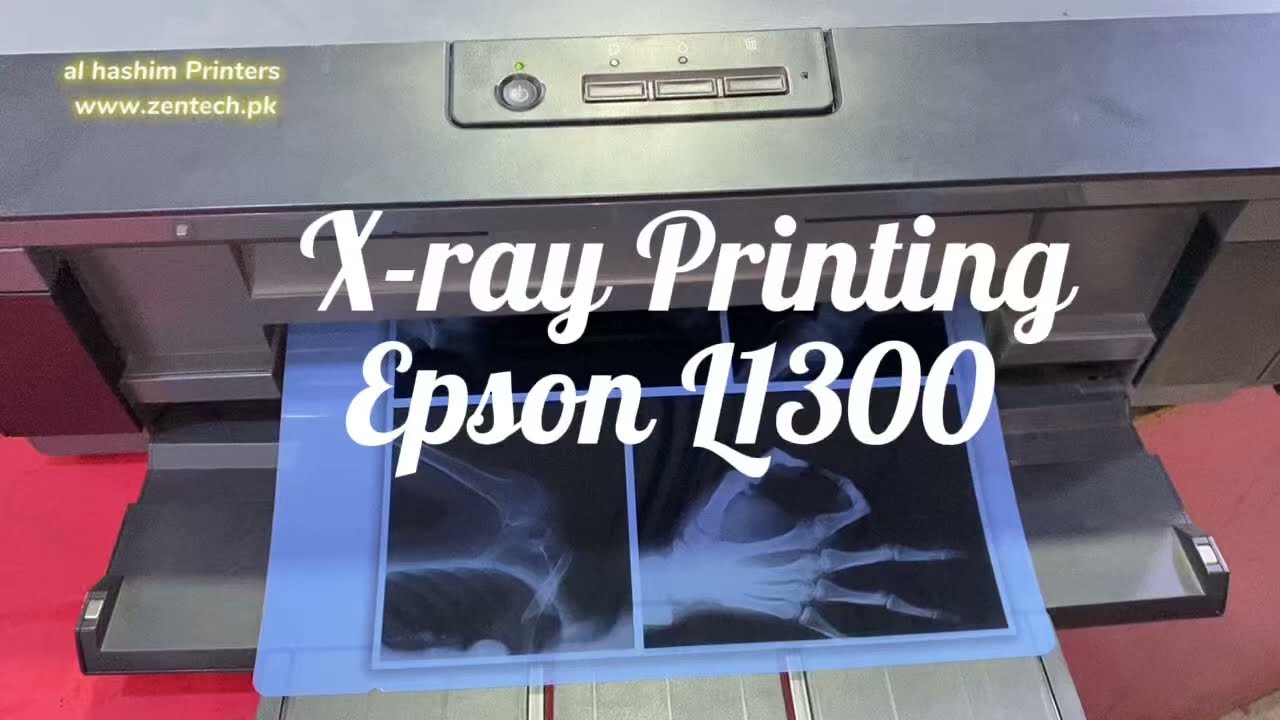 X-ray printing  Epson L1300 easy use