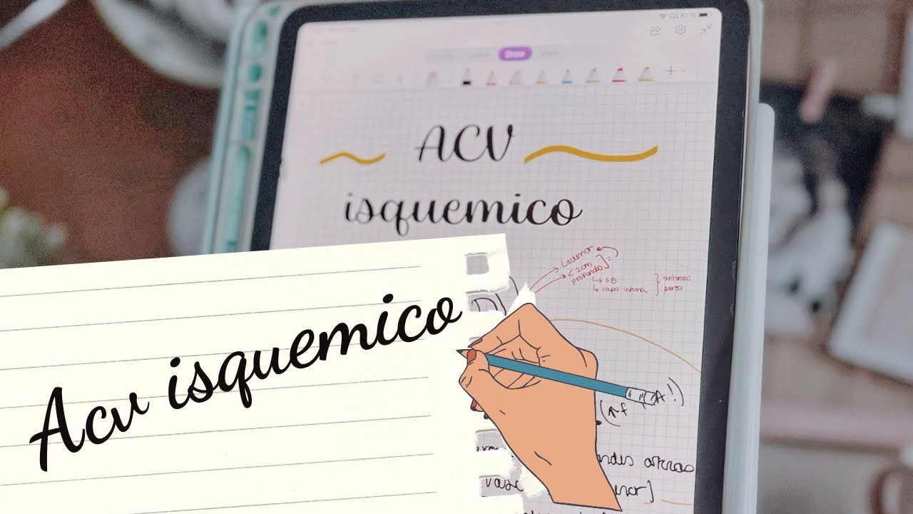 Accidente cerebrovascular isquemico