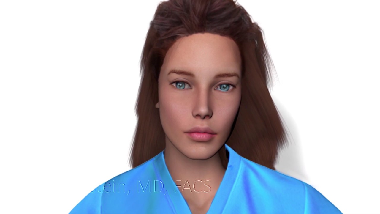 Animated video demonstrating hairline lowering surgery