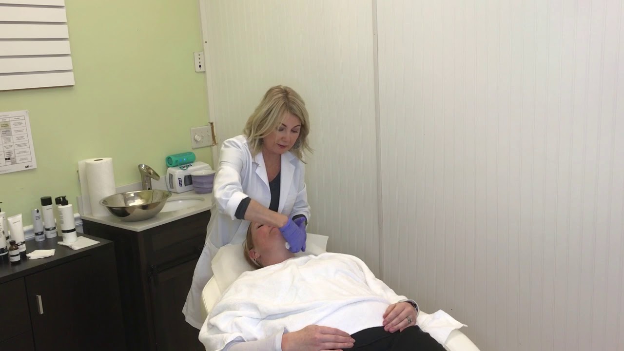 PCA Chemical Peel Demonstration