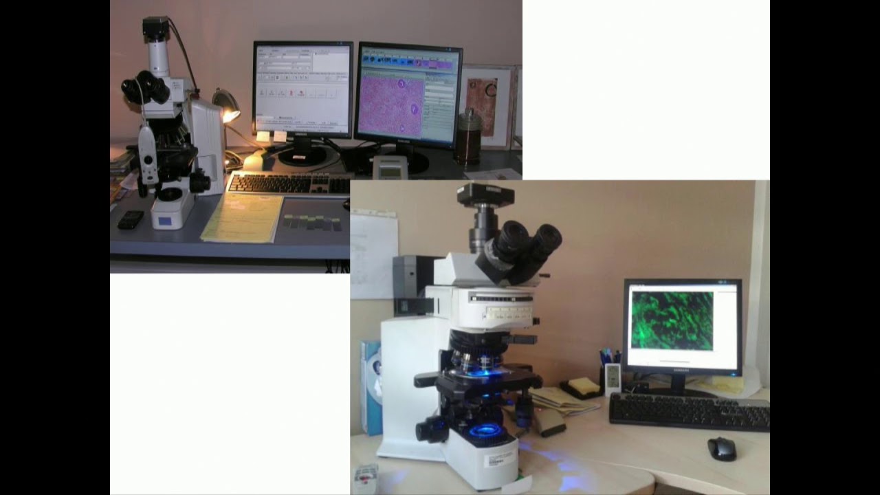 La lame virtuelle et le transfert d'images