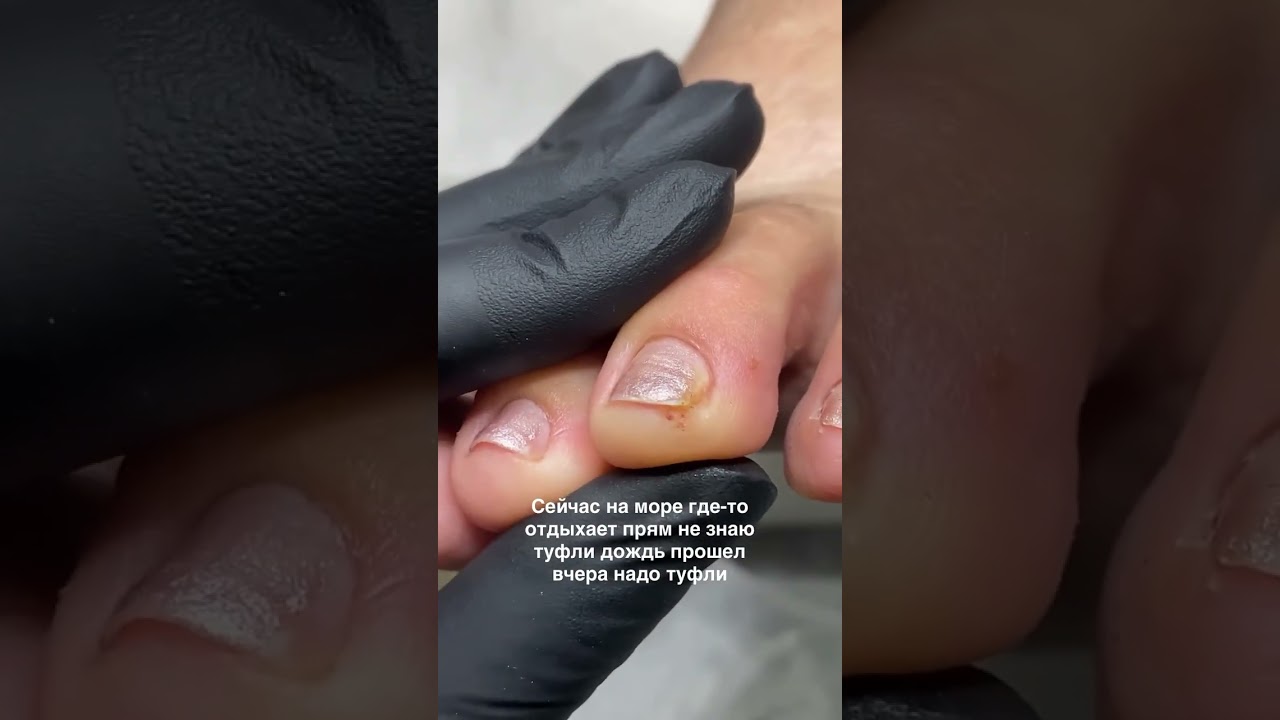 Что это? #подология #foot #консультация #обучениеподология