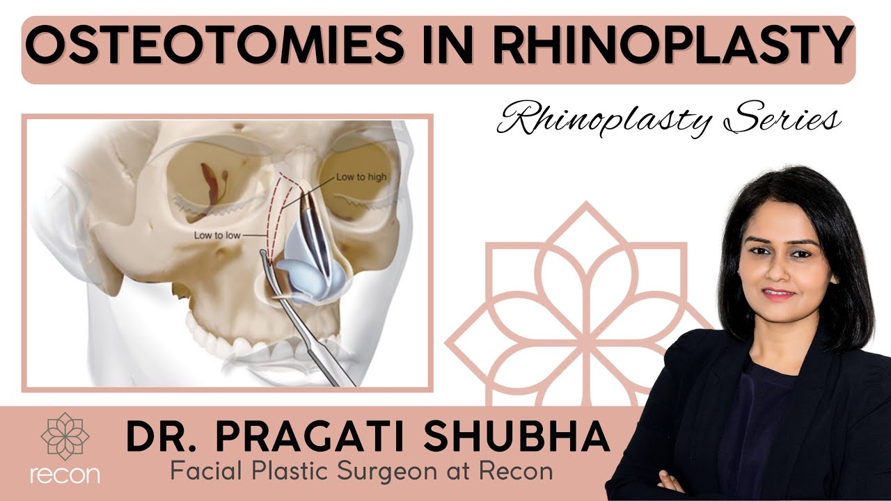 What Is Osteotomy In Rhinoplasty | Dr.Pragati Shubha