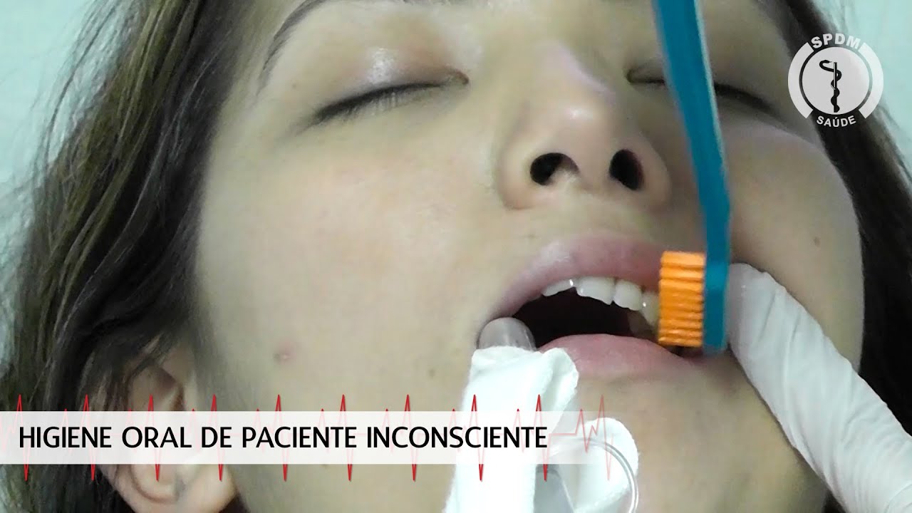 Higiene Oral do Paciente Inconsciente