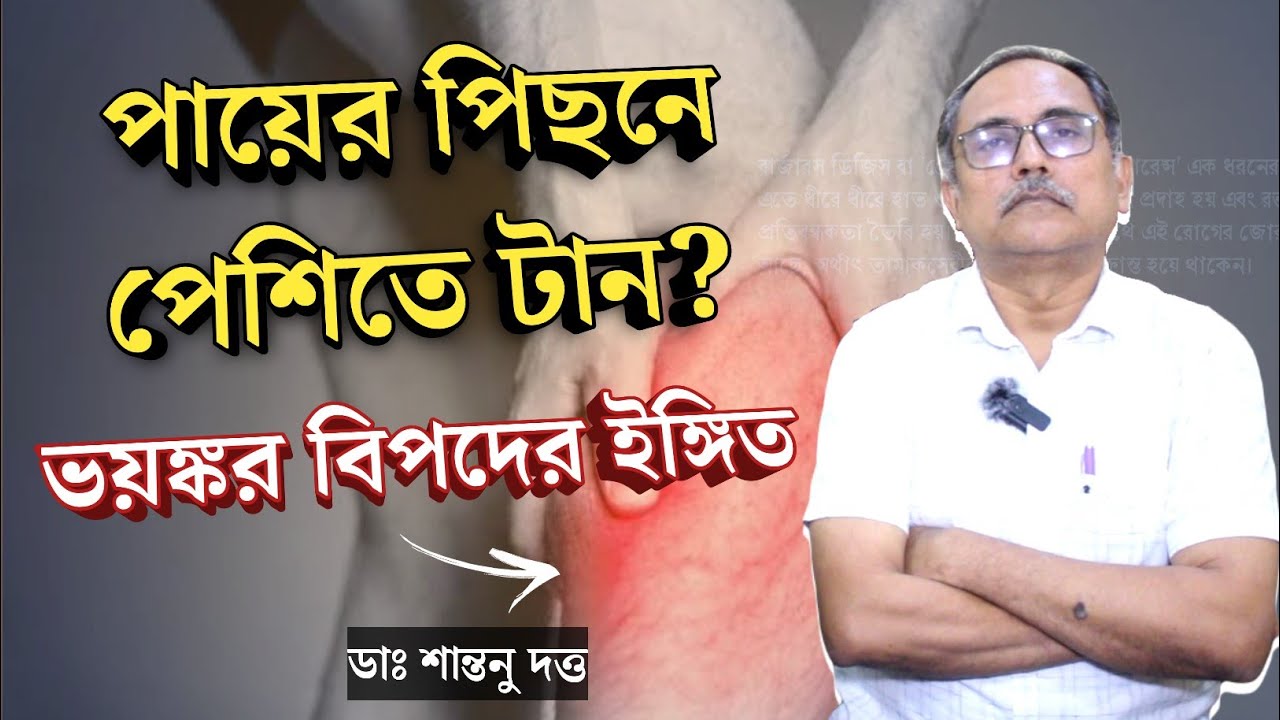 পায়ের পিছনে পেশিতে ব্যথা? ভয়ঙ্কর বিপদের ইঙ্গিত কি? | মাংসপেশির ব্যথার কারণ | Muscle Pain cause