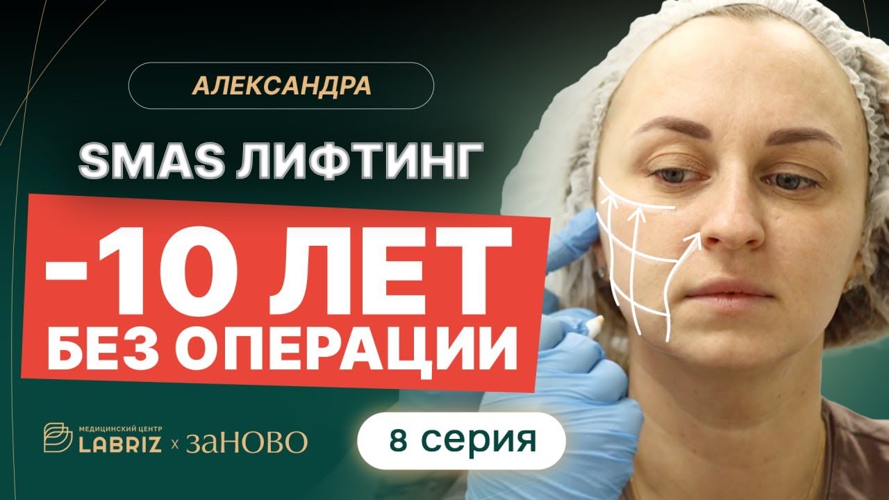 Минус 10 лет без операции? SMAS-лифтинг | Проект «Заново» ЛАБРИЗ