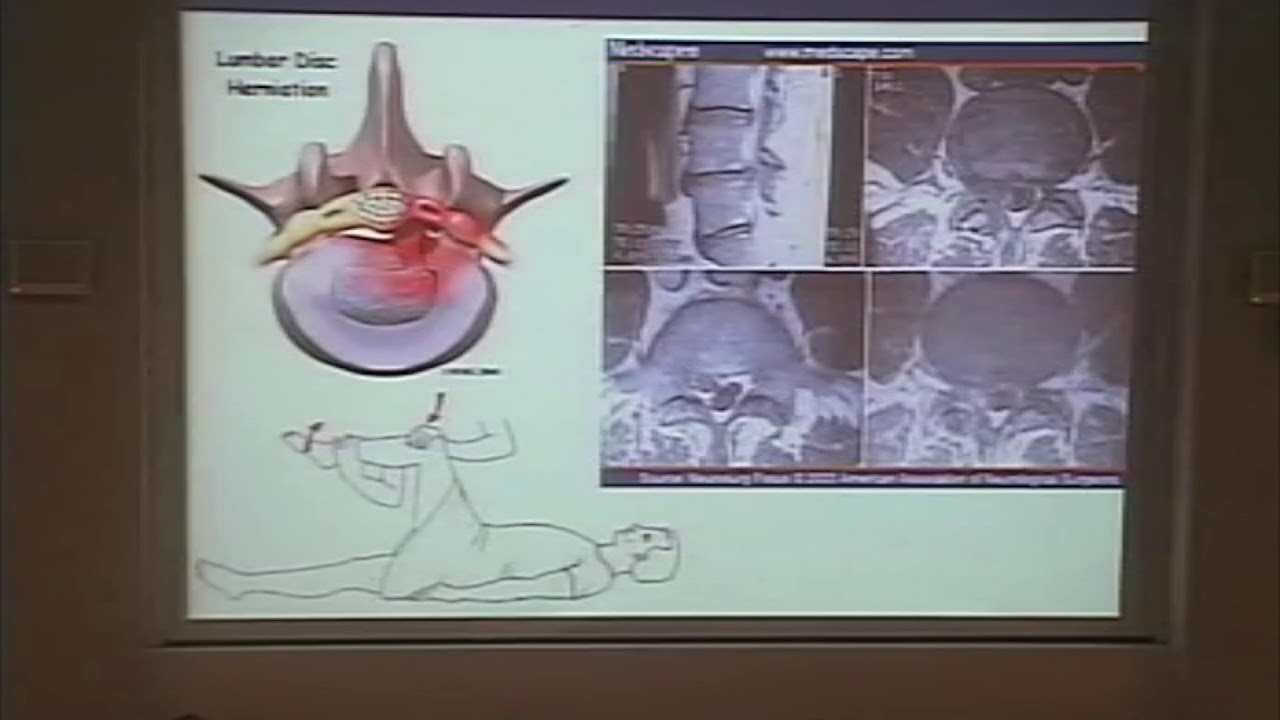Dr Tamburin - Anatomia funzionale del dolore e fisiopatologia del dolore neuropatico
