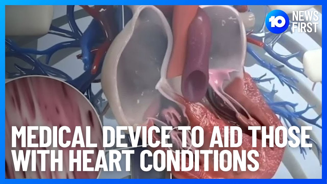 Medical Device To Circumvent High Risk Surgery | 10 News First