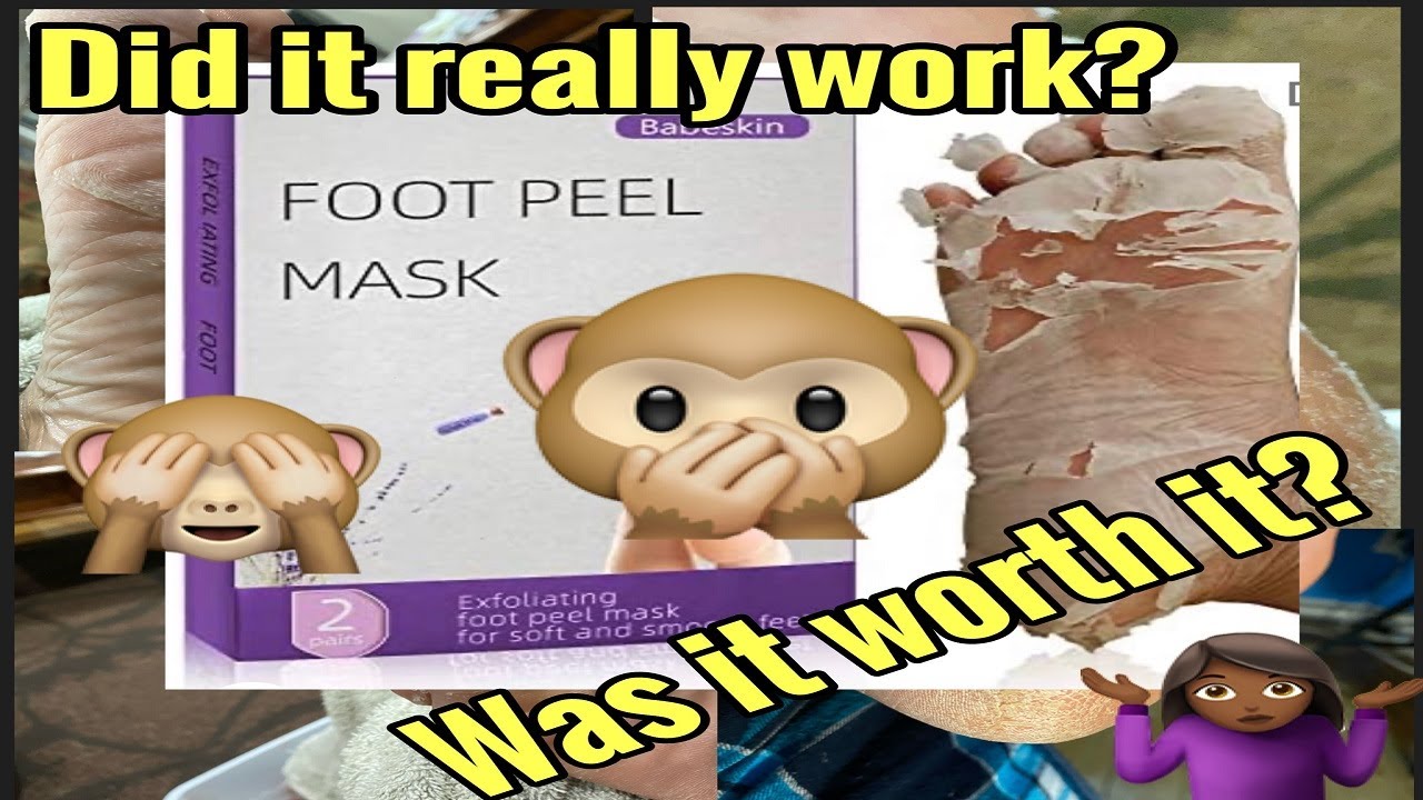Amazon: BabeSkin Foot Peel Mask Product Review