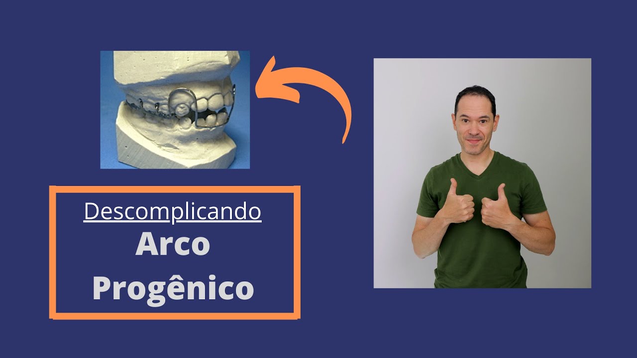 COMO FAZER ARCO PROGÊNICO EM APARELHO DE ORTODONTIA