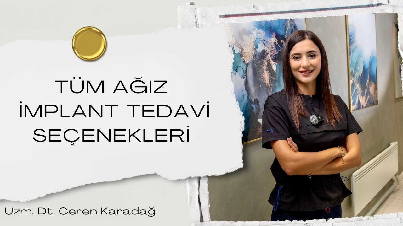 Tüm Ağız İmplant Tedavisi I Diş İmplant Tedavisinde Tüm Seçenekler