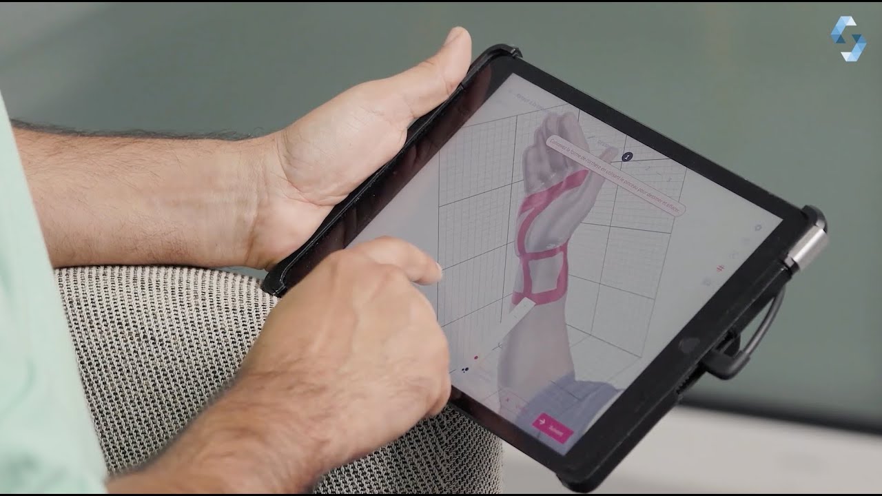 🦾 Why Dr. Razian Trusts Structure and Spentys for 3D Scanning and Custom Orthosis Design