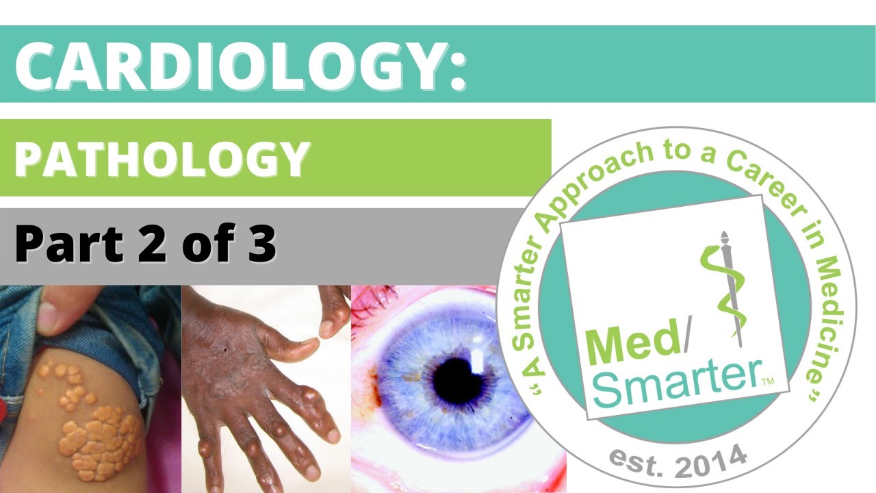 USMLE Step 1 | Cardiology: Pathology | MedSmarter | Part 2 of 3