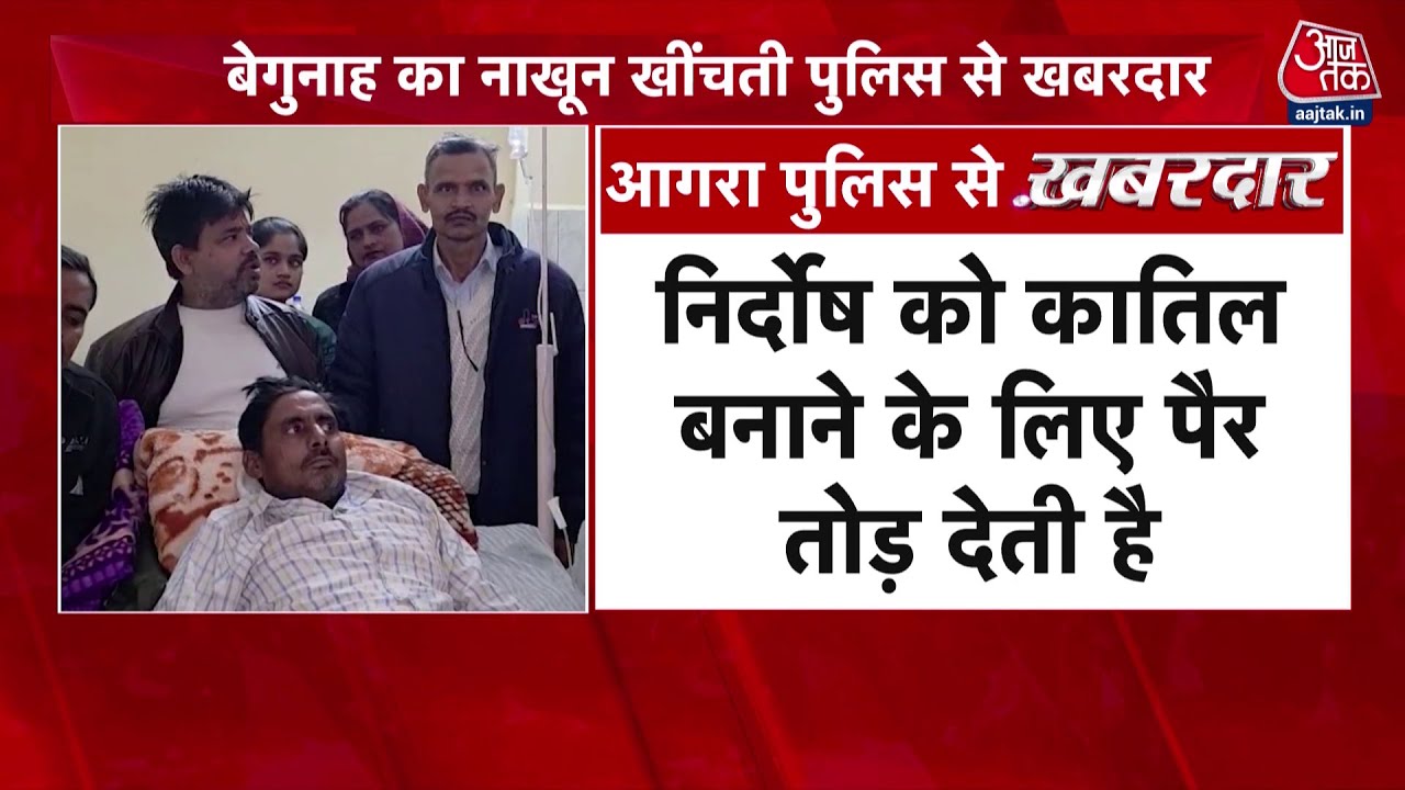 Agra Police: आगरा में पुलिस का बेरहम चेहरा, पहले निर्दोष का पैर तोड़ा...| UP Police | Aaj Tak