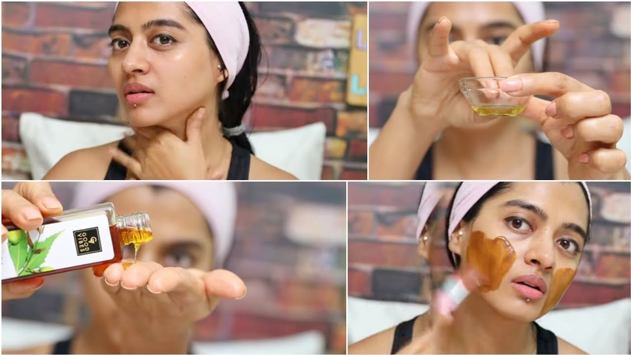 How To Use Neem for Beautiful Skin & Hair - Home Remedies for Acne DIY #MadeinIndia