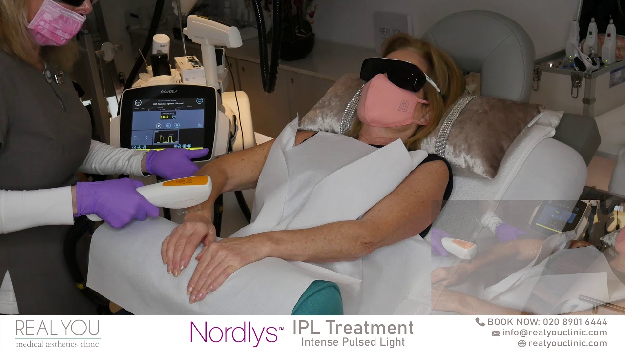 New ground-breaking Nordlys technology at The Real You Clinic - IPL (Intense Pulsed Light)